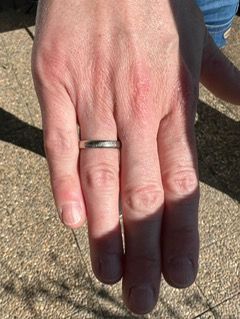 Schlüssel mit dem Metalldetektor wiedergefunden